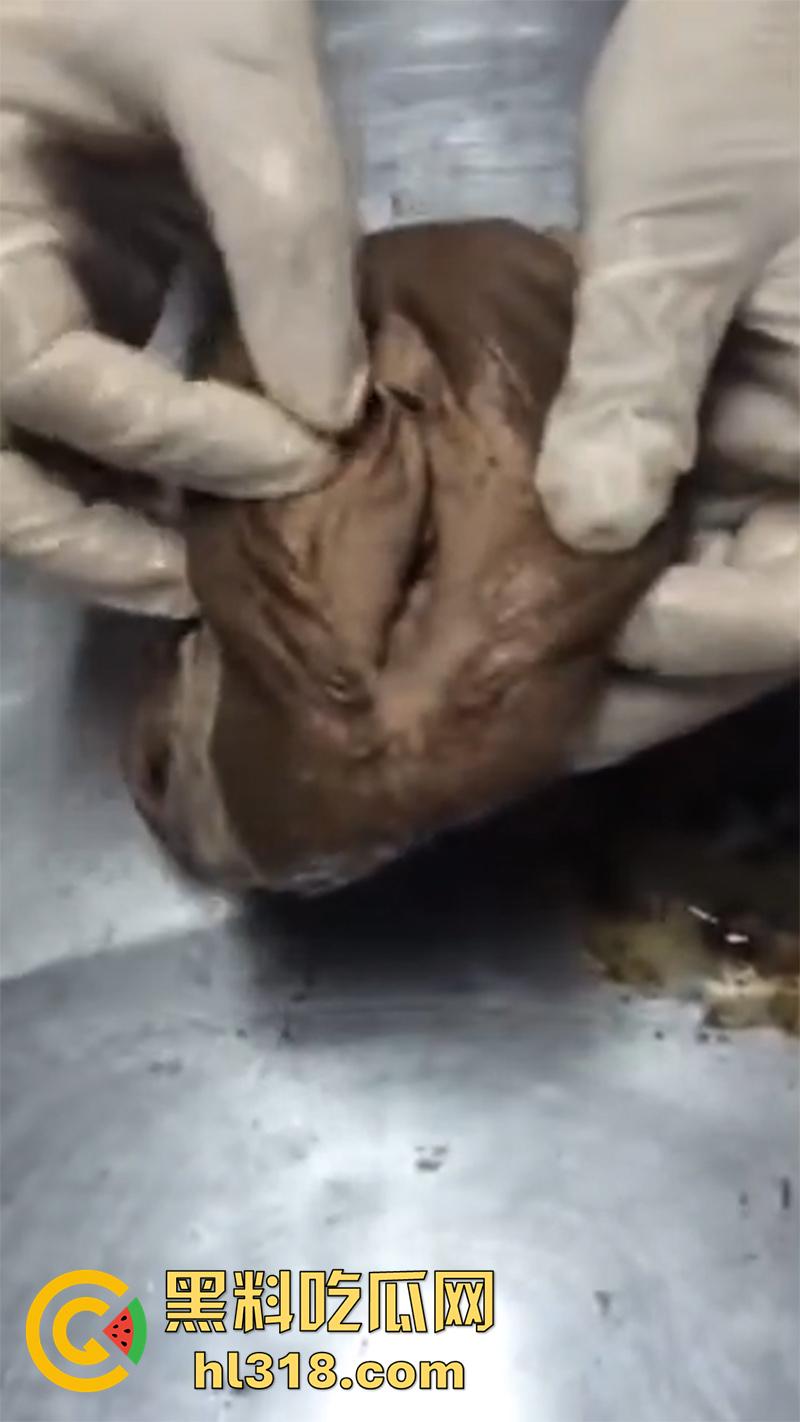 真实西藏密宗法器“肉莲花”，少女被108罗汉轮奸后，五毒侵蚀九蒸九炼，活体切割才可肉莲大成！-7